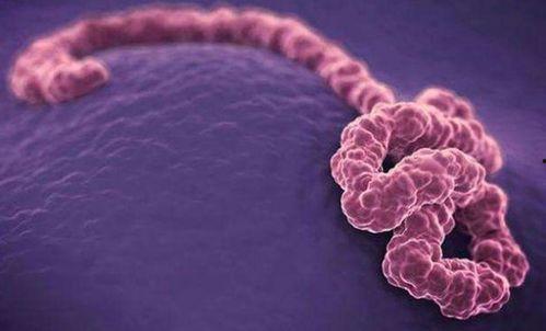 《伊波拉病毒》在线观看,揭秘致命病毒背后的真实故事